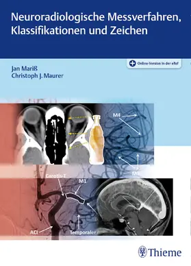 Mariß / Maurer |  Neuroradiologische Messverfahren, Klassifikationen und Zeichen - Mängelexemplar, kann leichte Gebrauchsspuren aufweisen. Sonderangebot ohne Rückgaberecht. Nur so lange der Vorrat reicht. | Buch |  Sack Fachmedien