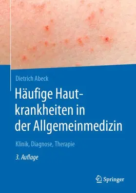 Abeck |  Häufige Hautkrankheiten in der Allgemeinmedizin - Mängelexemplar, kann leichte Gebrauchsspuren aufweisen. Sonderangebot ohne Rückgaberecht. Nur so lange der Vorrat reicht. | Buch |  Sack Fachmedien