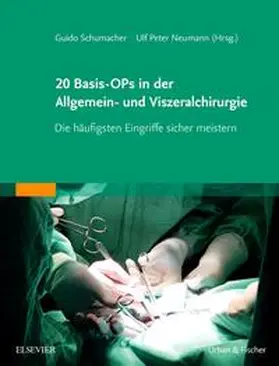 Schumacher / Neumann |  20 Basis-OPs in der Allgemein- und Viszeralchirurgie - Mängelexemplar, kann leichte Gebrauchsspuren aufweisen. Sonderangebot ohne Rückgaberecht. Nur so lange der Vorrat reicht. | Buch |  Sack Fachmedien