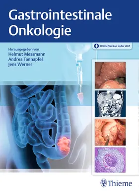 Messmann / Tannapfel / Werner |  Gastrointestinale Onkologie, Buch und eBook - Mängelexemplar, kann leichte Gebrauchsspuren aufweisen. Sonderangebot ohne Rückgaberecht. Nur so lange der Vorrat reicht. | Buch |  Sack Fachmedien