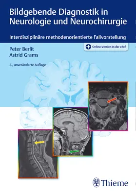 Berlit / Grams |  Bildgebende Diagnostik in Neurologie und Neurochirurgie - Mängelexemplar, kann leichte Gebrauchsspuren aufweisen. Sonderangebot ohne Rückgaberecht. Nur so lange der Vorrat reicht. | Buch |  Sack Fachmedien