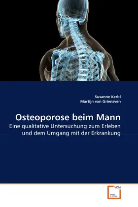 Kerbl |  Osteoporose beim Mann | eBook | Sack Fachmedien