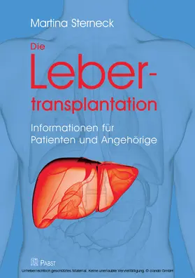 Sterneck |  Die Lebertransplantation | eBook | Sack Fachmedien