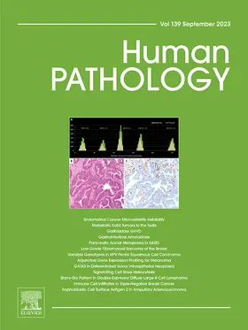 Human Pathology | W.B. Saunders | Zeitschrift | sack.de