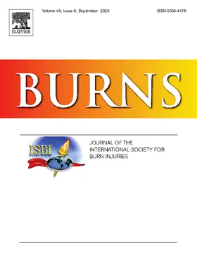 Burns | Elsevier | Zeitschrift | sack.de