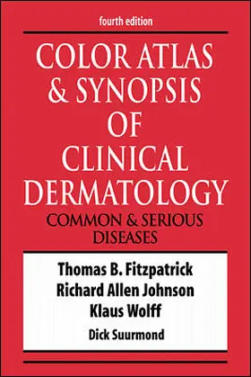 Fitzpatrick / Johnson / Wolff |  Color Atlas & Synopsis of Clinical Dermatology | Buch |  Sack Fachmedien