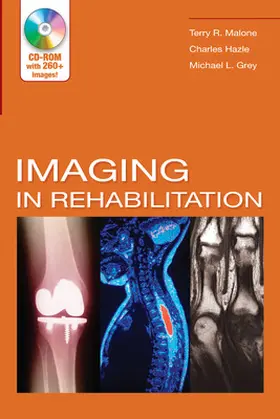 Malone / Hazle / Grey |  Imaging in Rehabilitation | Buch |  Sack Fachmedien