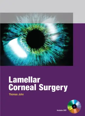John |  Lamellar Corneal Surgery | Buch |  Sack Fachmedien
