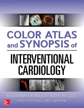 Baliga / Lilly |  Color Atlas and Synopsis of Interventional Cardiology | Buch |  Sack Fachmedien