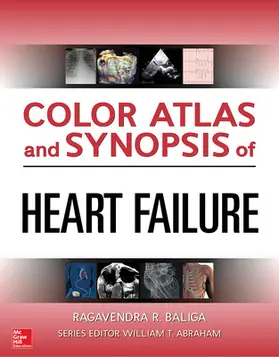 Baliga |  Color Atlas and Synopsis of Heart Failure | Buch |  Sack Fachmedien