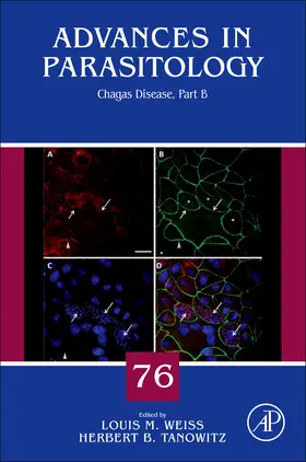  Chagas Disease | Buch |  Sack Fachmedien