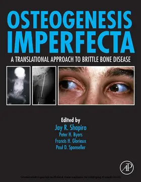 Kassim / Sponseller MD / Sponseller | Osteogenesis Imperfecta | E-Book | sack.de