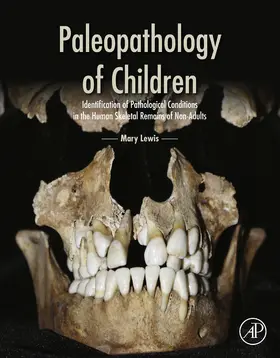 Lewis | Paleopathology of Children | E-Book | sack.de