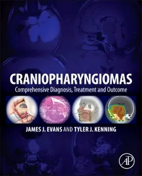 Evans / Kenning | Craniopharyngiomas | Buch | 978-0-12-416706-3 | www2.sack.de