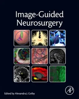 Golby |  Image-Guided Neurosurgery | Buch |  Sack Fachmedien