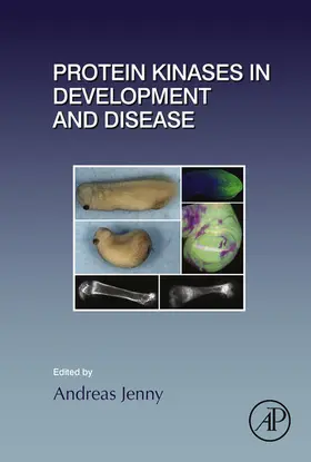Jenny |  Protein Kinases in Development and Disease | eBook | Sack Fachmedien