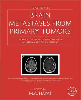 Hayat |  Brain Metastases from Primary Tumors, Volume 3: Epidemiology, Biology, and Therapy of Melanoma and Other Cancers | Buch |  Sack Fachmedien