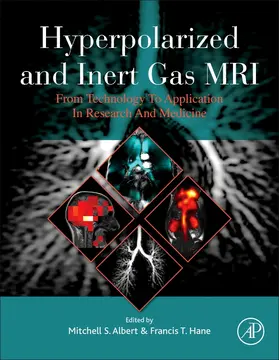 Albert / Hane |  Hyperpolarized and Inert Gas MRI | Buch |  Sack Fachmedien