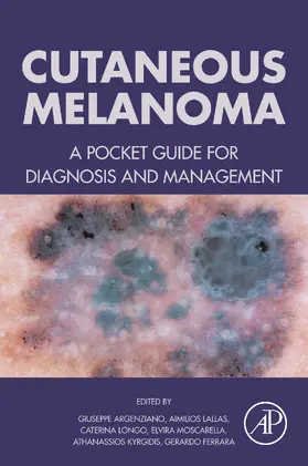 Argenziano MD / Argenziano / Lallas | Cutaneous Melanoma | E-Book | sack.de