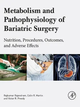 Rajendram AKC / Rajendram / Martin BSc | Metabolism and Pathophysiology of Bariatric Surgery | E-Book | sack.de