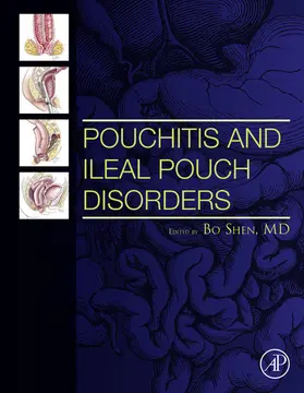 Shen MD / Shen |  Pouchitis and Ileal Pouch Disorders | eBook | Sack Fachmedien