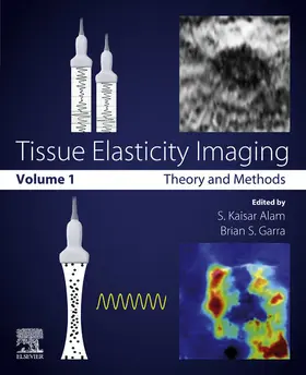 Alam / Garra | Tissue Elasticity Imaging | E-Book | sack.de