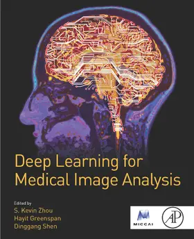Zhou / Greenspan / Shen |  Deep Learning for Medical Image Analysis | eBook | Sack Fachmedien