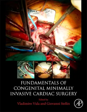 Stellin / Vida |  Fundamentals of Congenital Minimally Invasive Cardiac Surgery | Buch |  Sack Fachmedien
