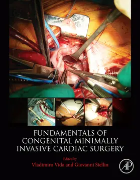 Vida / Stellin |  Fundamentals of Congenital Minimally Invasive Cardiac Surgery | eBook | Sack Fachmedien