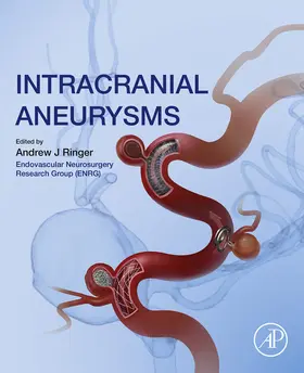 Ringer | Intracranial Aneurysms | E-Book | sack.de