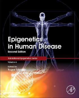 O. Tollefsbol |  Epigenetics in Human Disease | Buch |  Sack Fachmedien