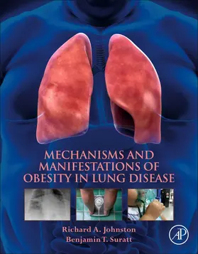 Johnston / Suratt |  Mechanisms and Manifestations of Obesity in Lung Disease | Buch |  Sack Fachmedien