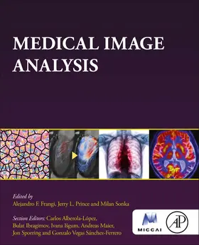 Frangi / Prince |  Medical Image Analysis | Buch |  Sack Fachmedien