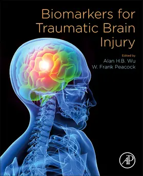 Wu / Peacock |  Biomarkers for Traumatic Brain Injury | Buch |  Sack Fachmedien