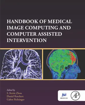 Zhou / Rueckert / Fichtinger |  Handbook of Medical Image Computing and Computer Assisted Intervention | eBook | Sack Fachmedien