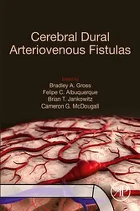 Gross / Albuquerque / Jankowitz |  Cerebral Dural Arteriovenous Fistulas | eBook | Sack Fachmedien