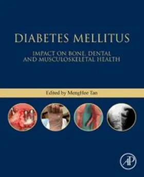 Tan | Diabetes Mellitus | E-Book | www2.sack.de
