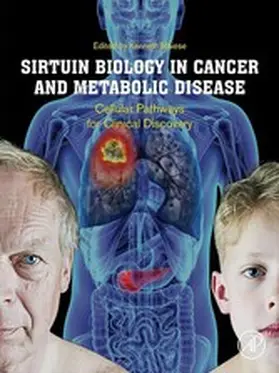 Maiese | Sirtuin Biology in Cancer and Metabolic Disease | E-Book | sack.de