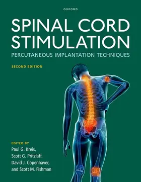 Kreis / Pritzlaff / Copenhaver |  Spinal Cord Stimulation | Buch |  Sack Fachmedien