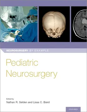 Selden / Baird |  Pediatric Neurosurgery | Buch |  Sack Fachmedien