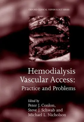 Conlon / Nicholson / Schwab |  Hemodialysis Vascular Access | Buch |  Sack Fachmedien