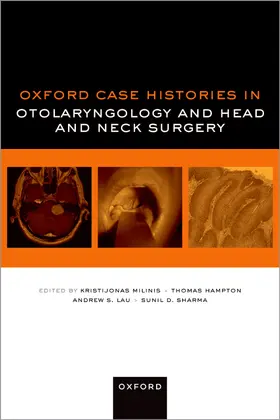 Milinis / Hampton / Lau |  Oxford Case Histories in Otolaryngology and Head and Neck Surgery | Buch |  Sack Fachmedien