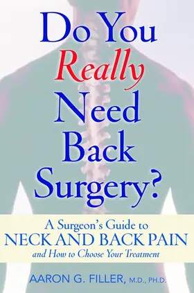 Filler |  Do You Really Need Back Surgery? | Buch |  Sack Fachmedien