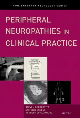 Herskovitz / Scelsa / Schaumburg |  Peripheral Neuropathies in Clinical Practice | Buch |  Sack Fachmedien