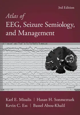 Abou-Khalil / Misulis / Sonmezturk |  Atlas of Eeg, Seizure Semiology, and Management | Buch |  Sack Fachmedien