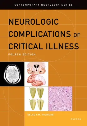 Wijdicks |  Neurologic Complications of Critical Illness | Buch |  Sack Fachmedien