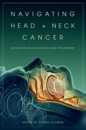 Dlamini |  Navigating Head and Neck Cancer | Buch |  Sack Fachmedien