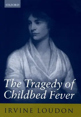 Loudon |  The Tragedy of Childbed Fever | Buch |  Sack Fachmedien