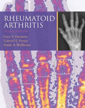 Firestein / Panayi / Wollheim |  Rheumatoid Arthritis | Buch |  Sack Fachmedien