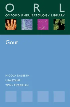 Dalbeth / Stamp / Merriman |  Gout | Buch |  Sack Fachmedien